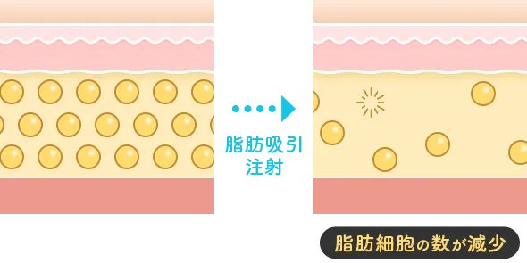 脂肪細胞イメージイラスト