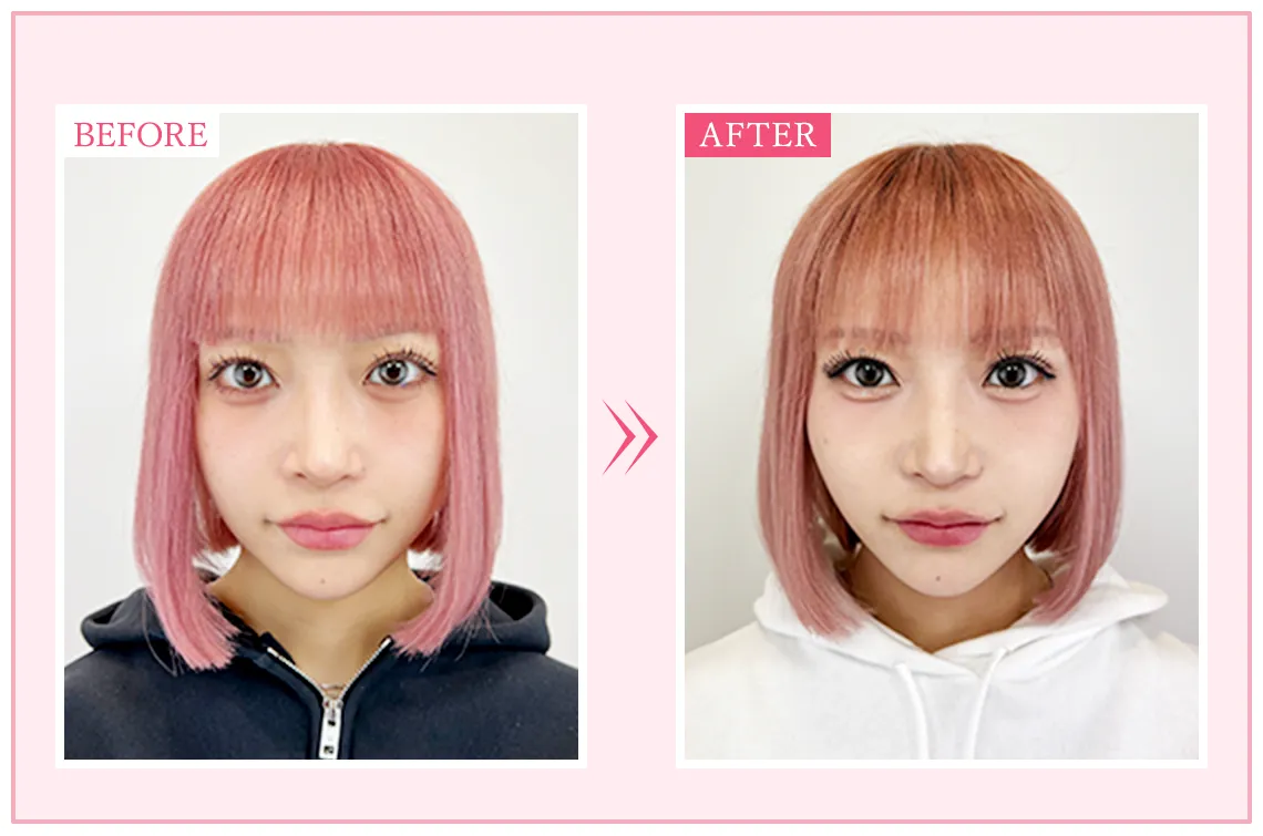 ビフォーアフター