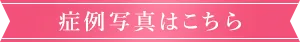 症例写真はこちら