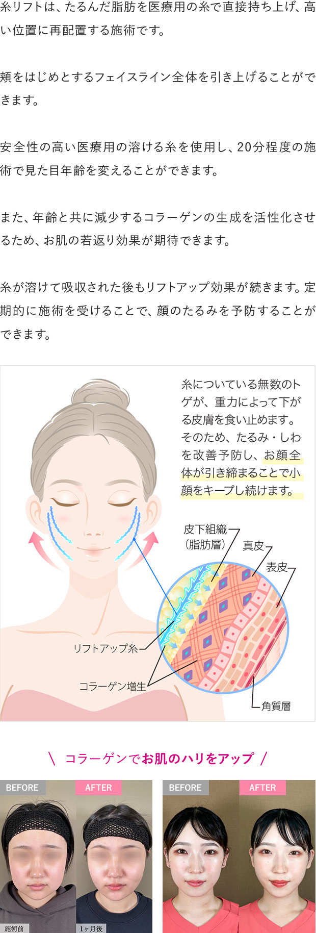 特徴１テキスト