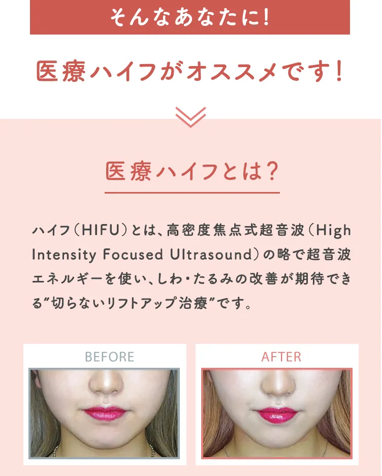 そんなあなたに！すぐに効果を実感できる医療ハイフで解決！