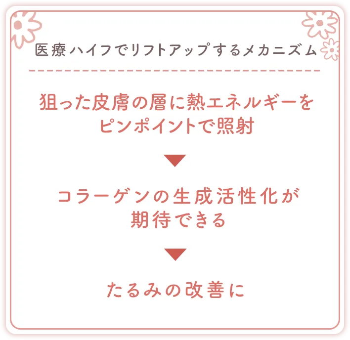 医療ハイフでリフトアップするメカニズム