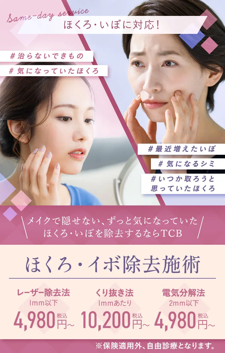 ほくろ・いぼを即日対応！TCB 1Day ほくろ・イボ除去施術