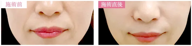 症例
