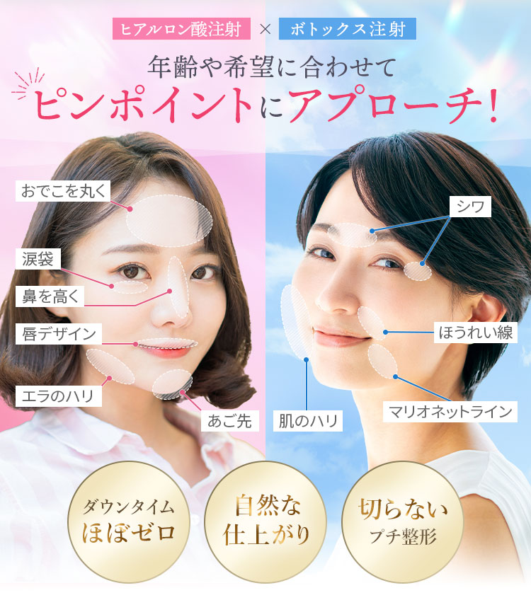 ヒアルロン酸注射✕ボトックス注射