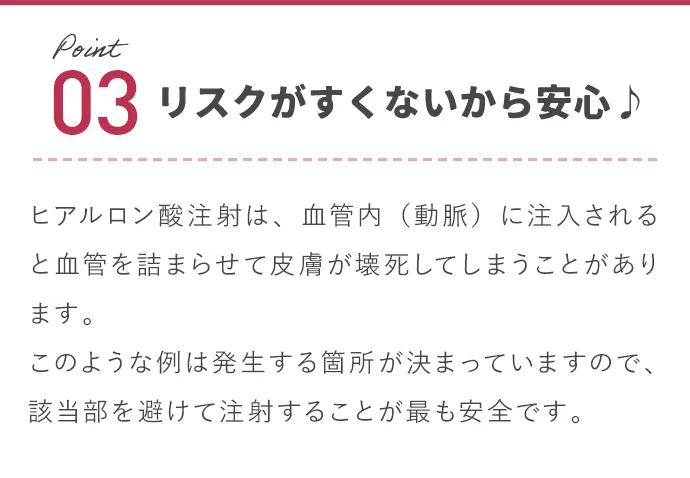 リスクがすくないから安心♪