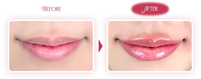 ビフォーアフター