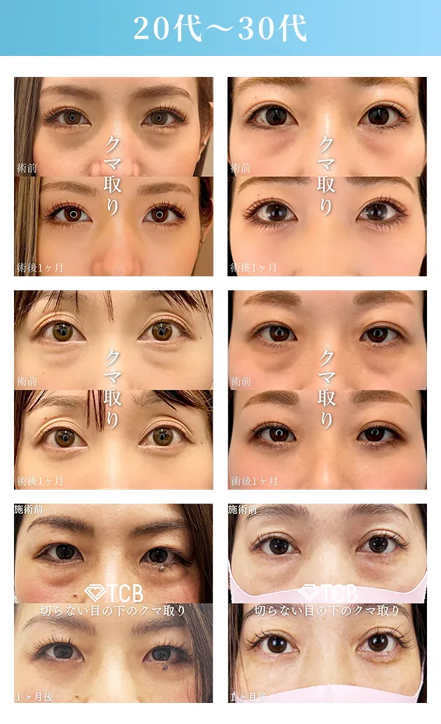 20代～30代の症例写真