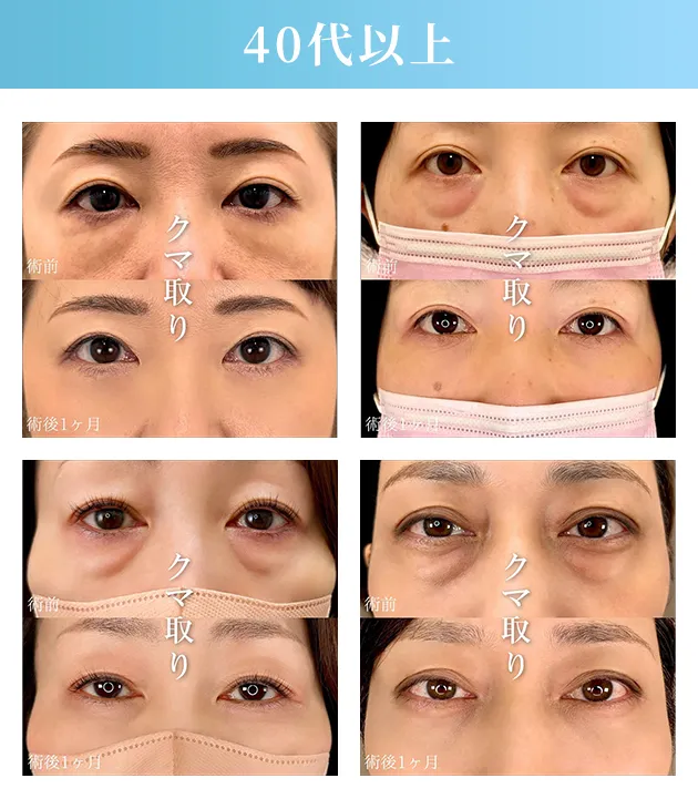 40代以上の症例写真