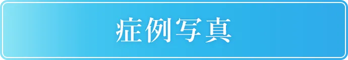 症例写真