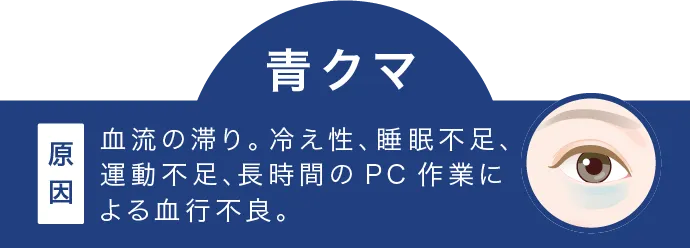 血流の滞り。冷え性、睡眠不足、運動不足、長時間のPC作業による血行不良。