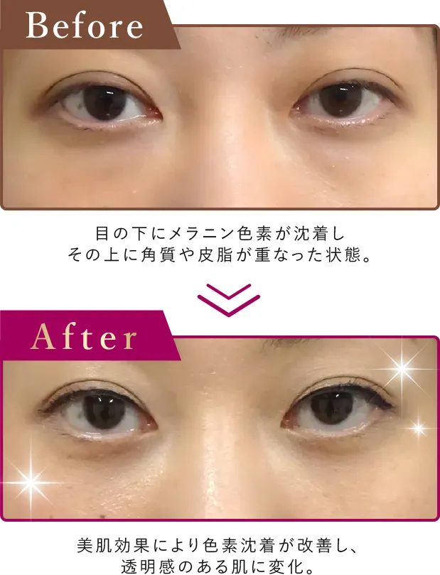 茶クマの症例写真