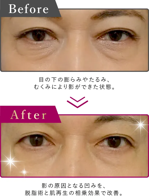 黒クマの症例写真