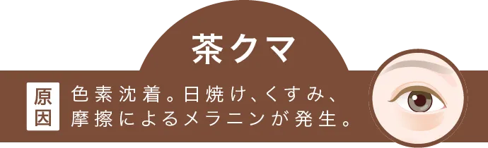 色素沈着。日焼け、くすみ、摩擦によるメラニンが発生。