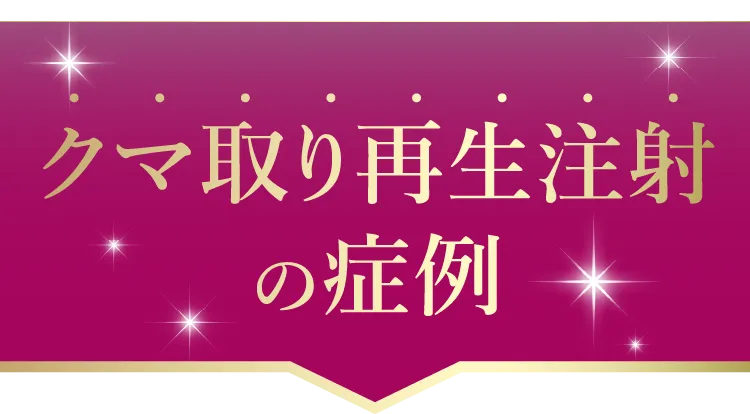 クマ取り再生注射はすべてのクマに効果的