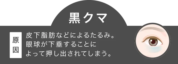 皮下脂肪などによるたるみ。眼球が下垂することによって押し出されてしまう。