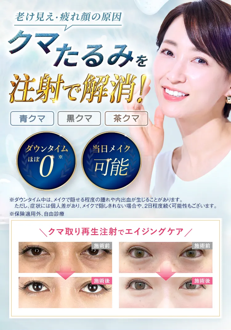 あなたを老けて見せるクマ・たるみに...一撃