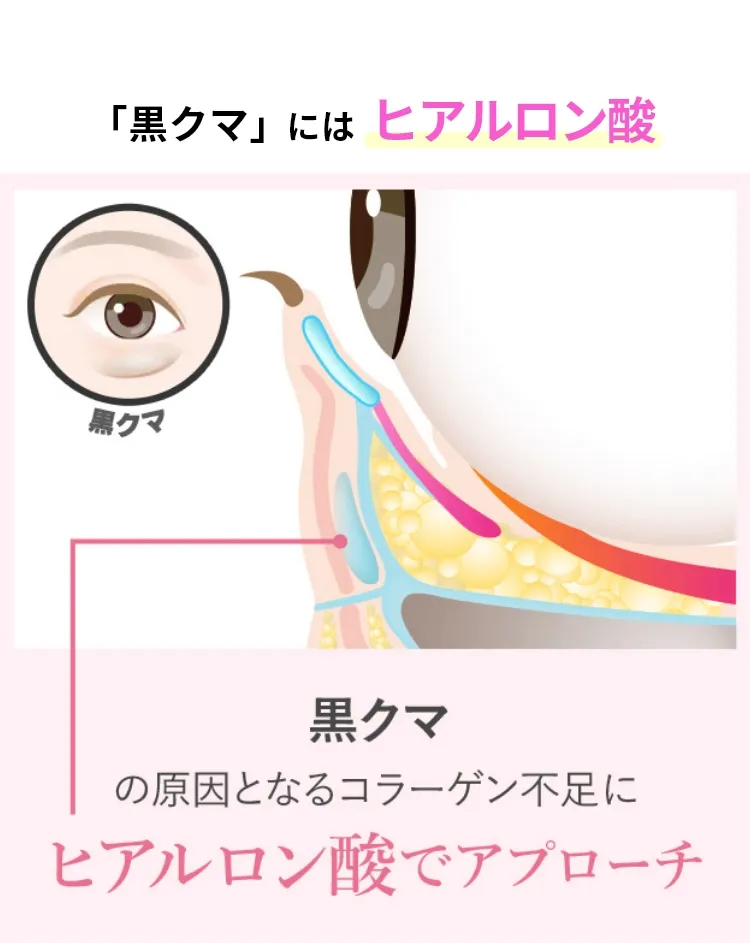 クマ取り再生注射の記事