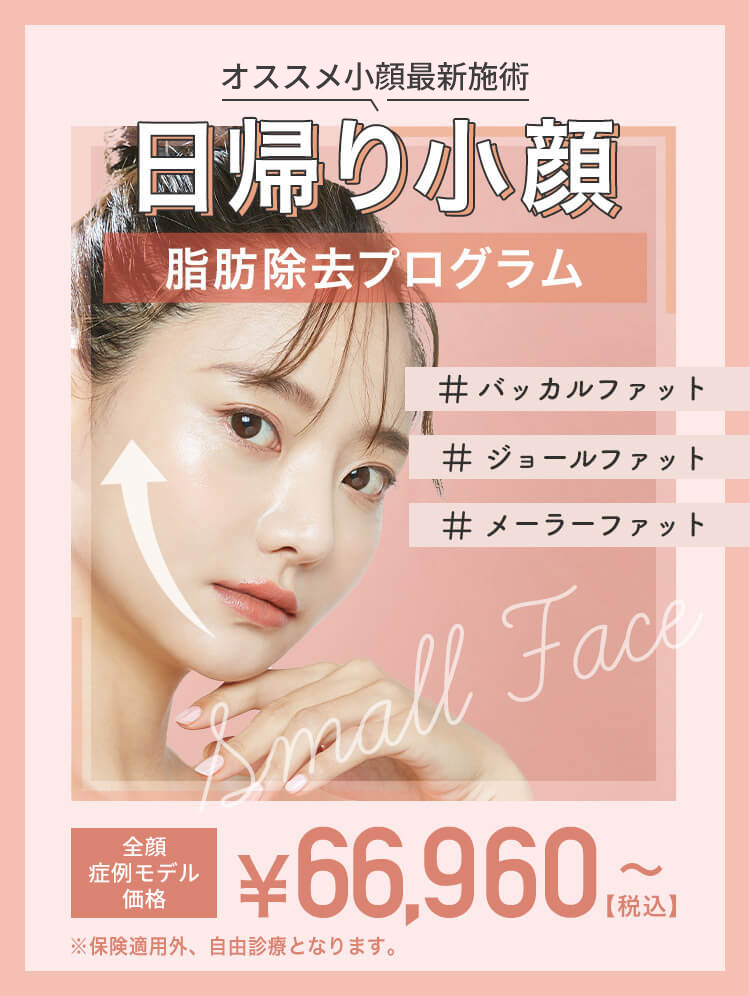 日帰り小顔除去プログラム