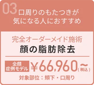 顔の脂肪除去