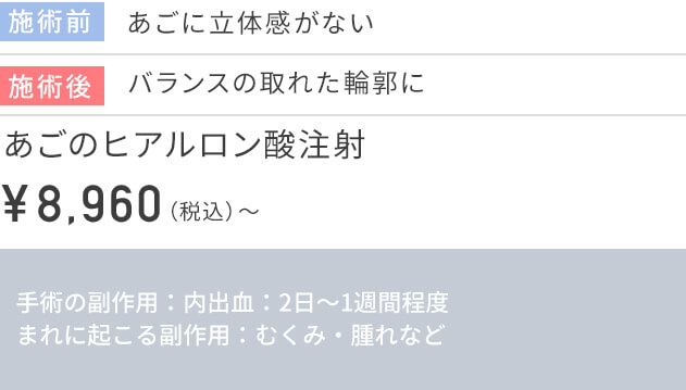 CASE1 ヒアルロン酸注射の価格