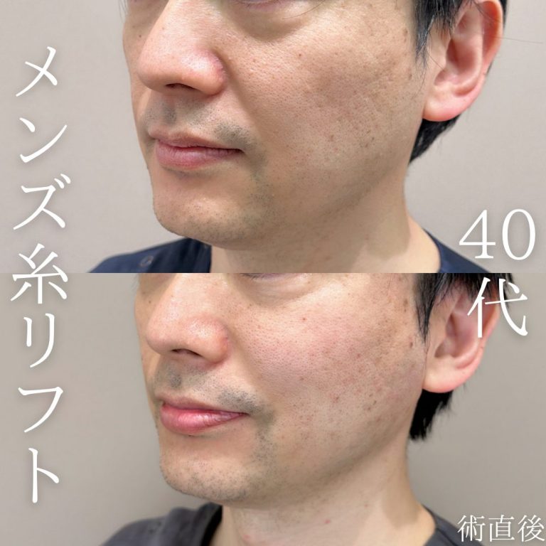 小顔の症例写真