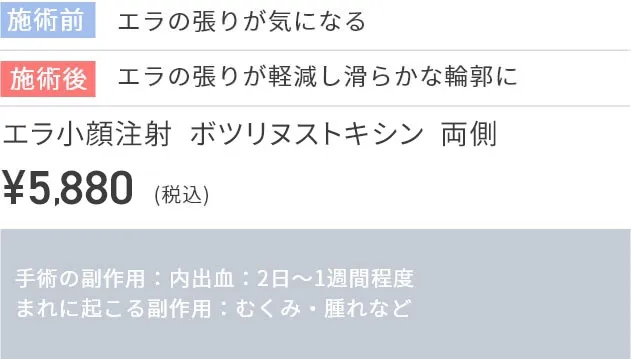 施術前