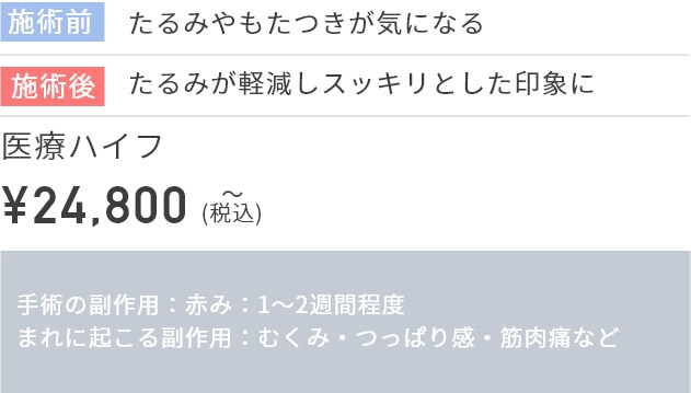 施術前