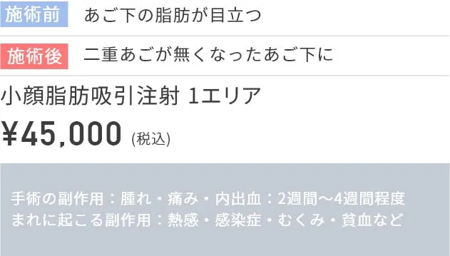 施術前