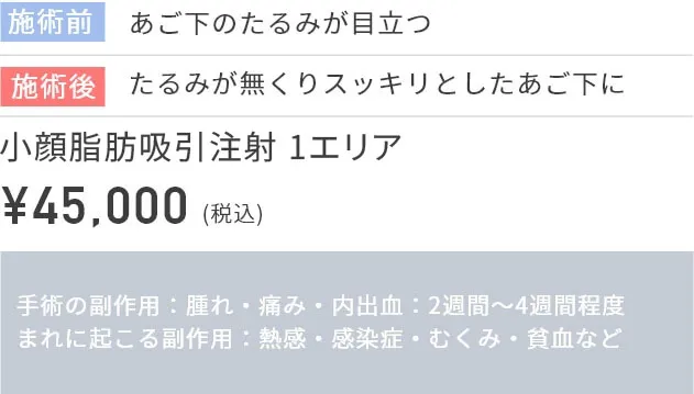 施術前