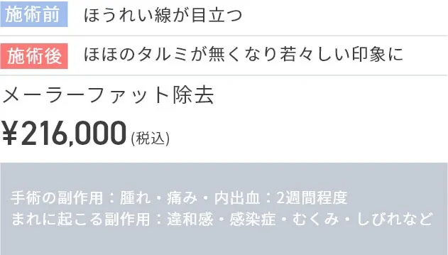 施術前
