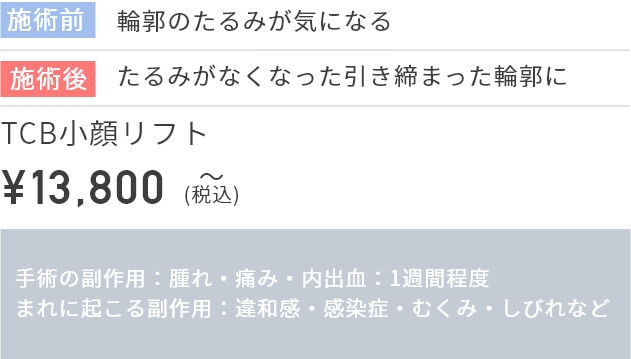 施術前
