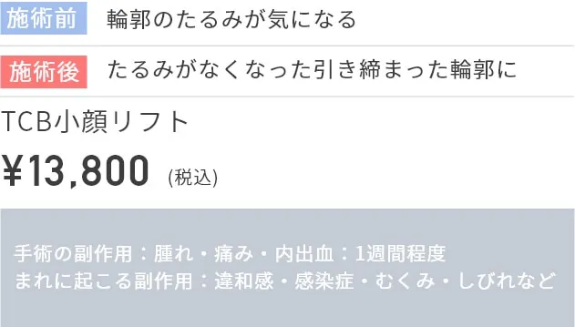 施術前