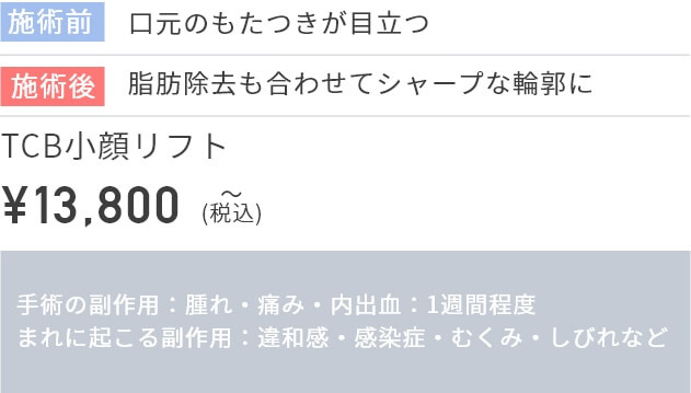 施術前