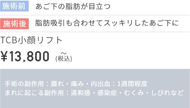 施術前