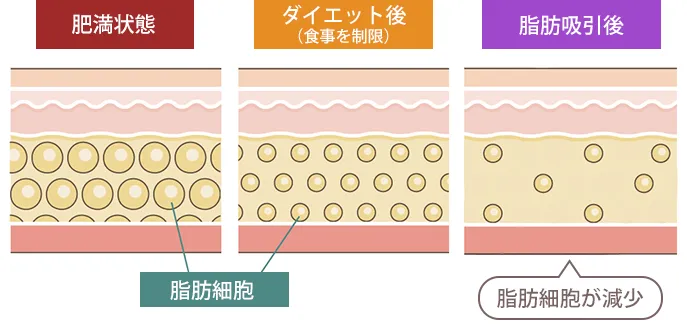 脂肪細胞