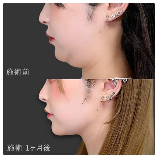 症例写真1