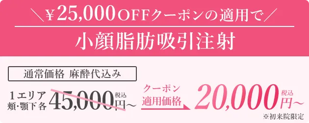 25,000円OFFクーポン