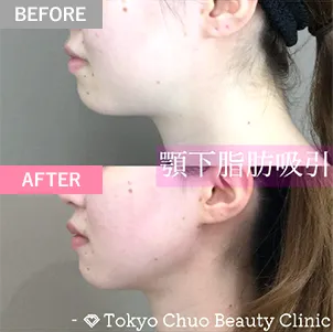 症例写真2