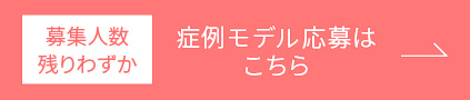 症例モデル応募はこちら