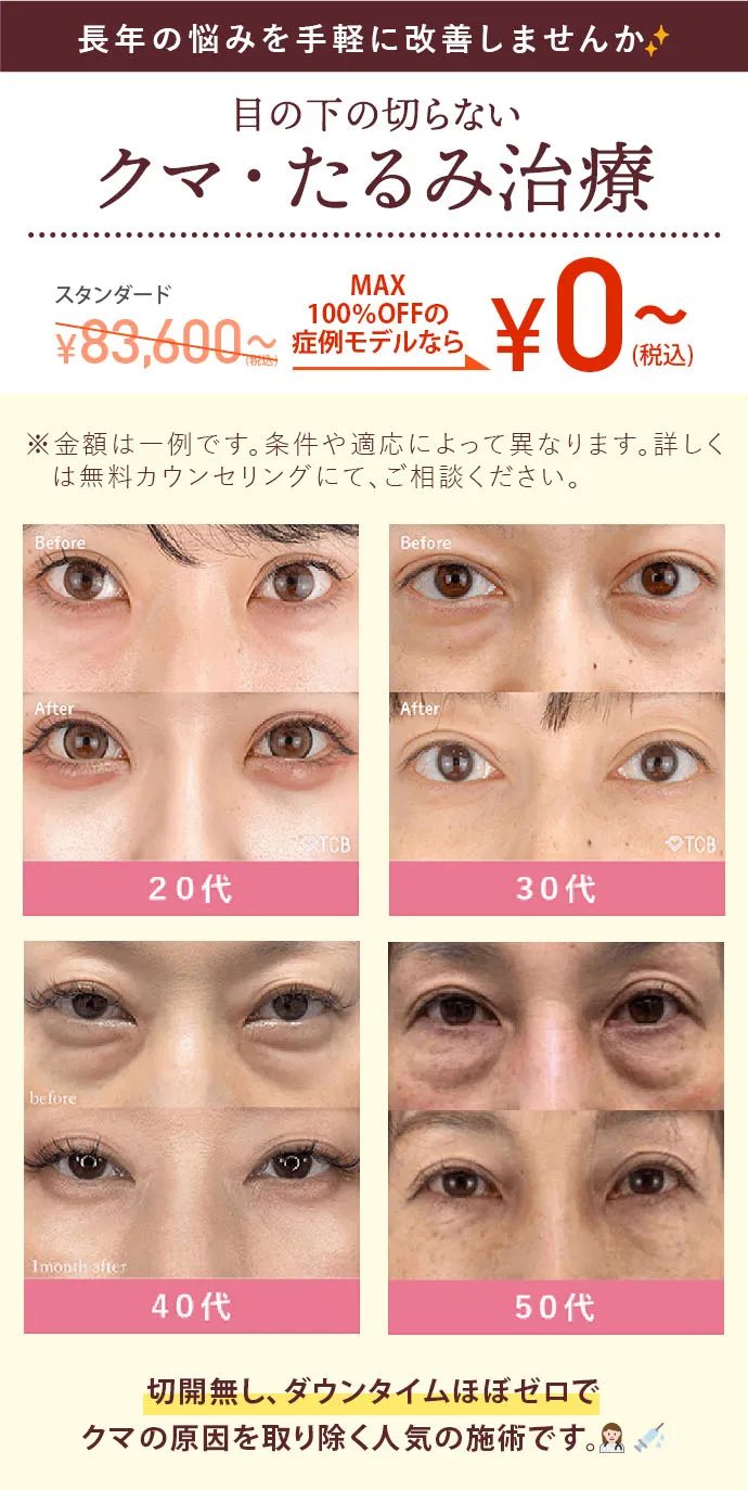 目元のクマ・たるみ治療