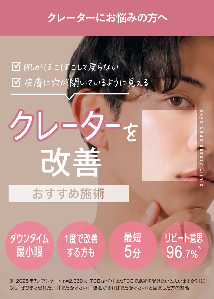 クレーターを治す