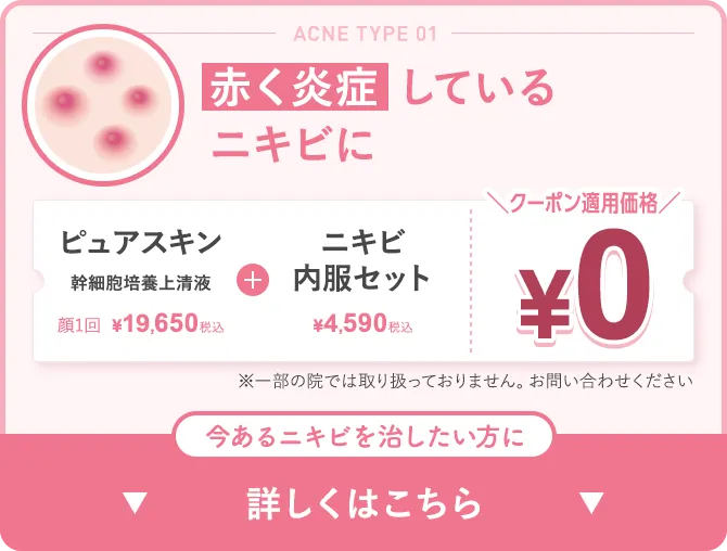赤く炎症しているニキビに