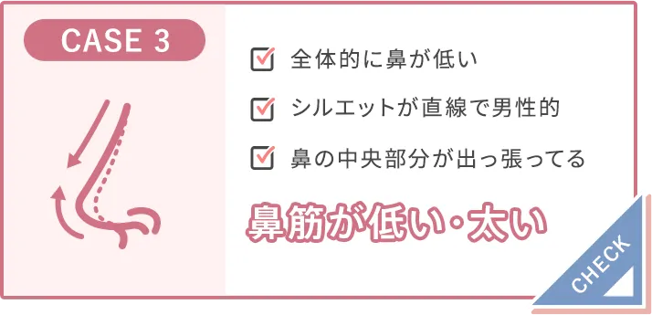 筋が曲がっている（わし鼻）