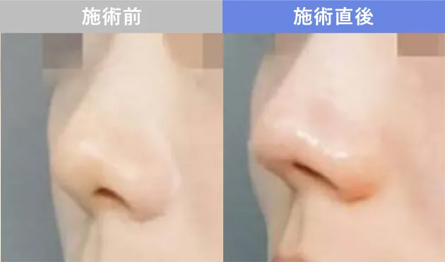 症例