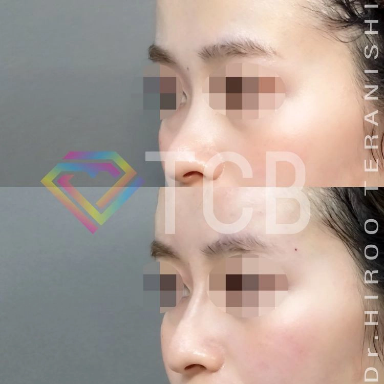 鼻の症例写真