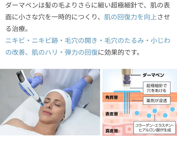 ダーマペン4の説明