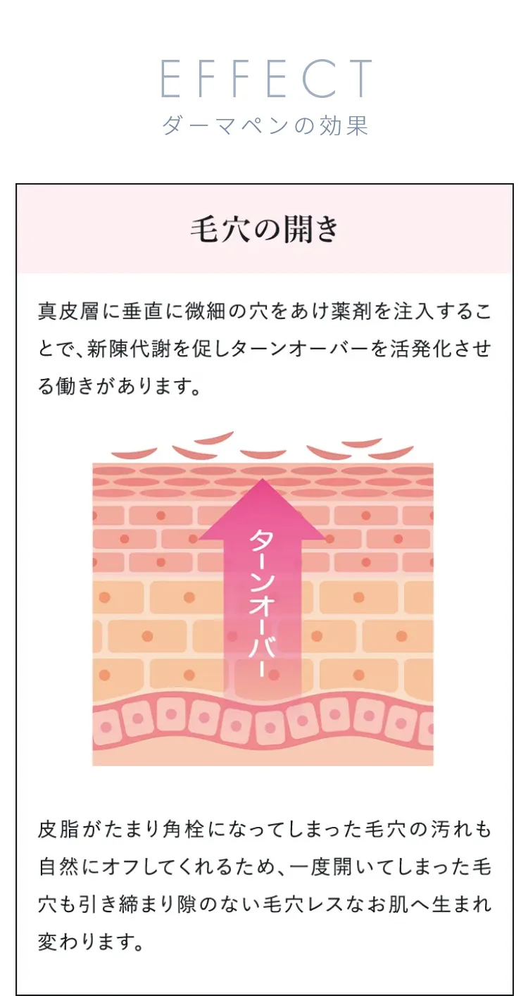 ダーマペン4の効果1