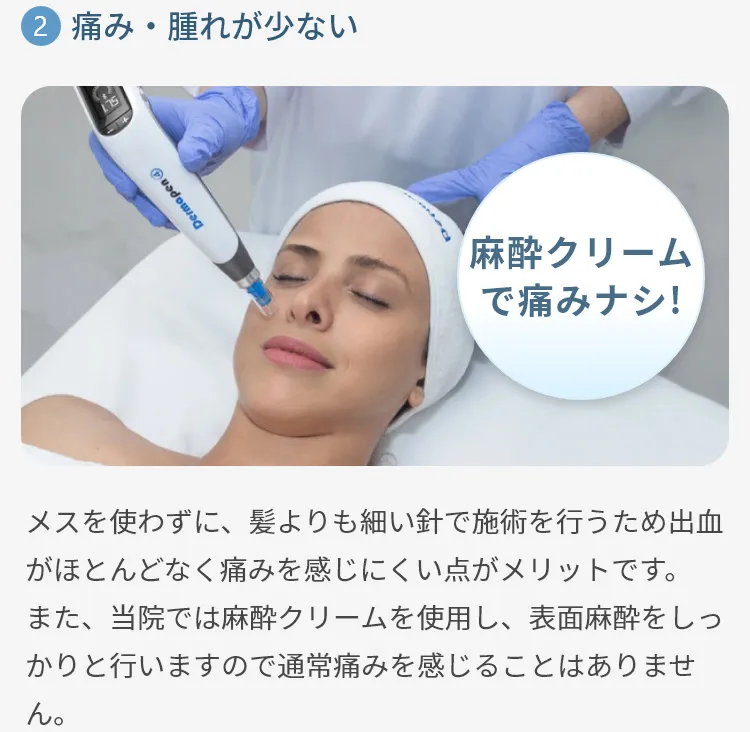 ダーマペン4の効果5