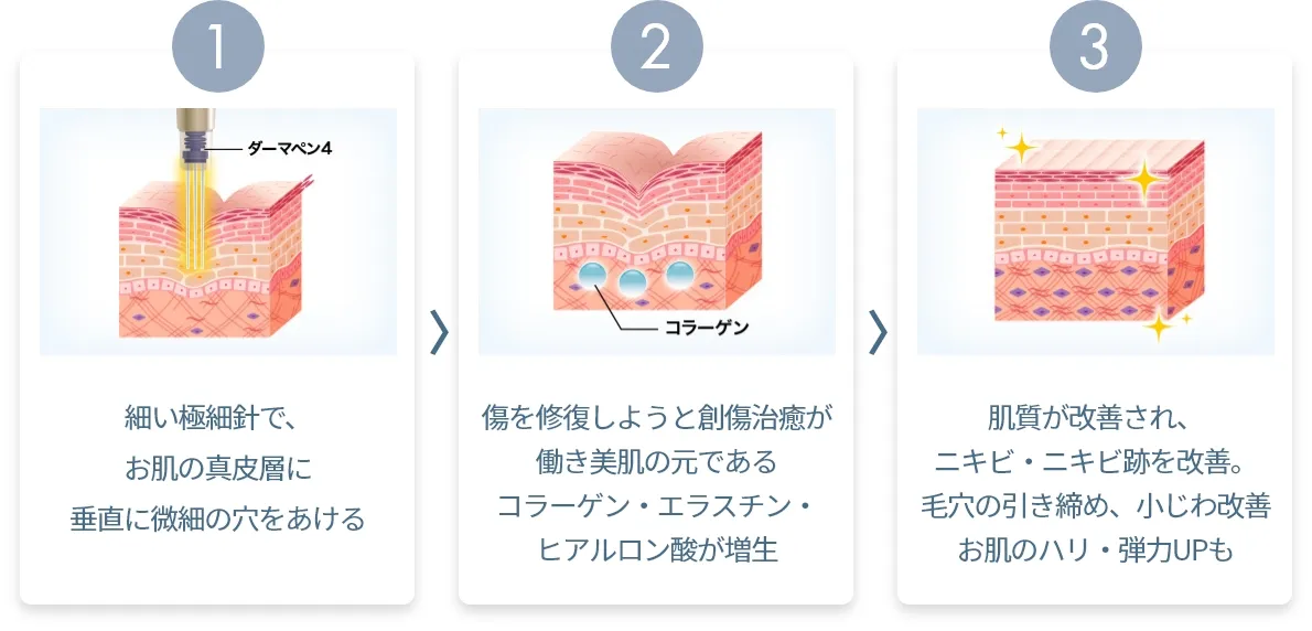 3ステップ